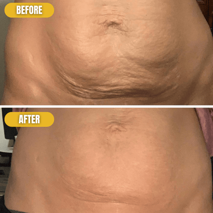 Anti-Cellulite Massage Oil